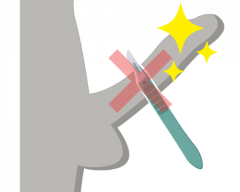 切らない包茎手術