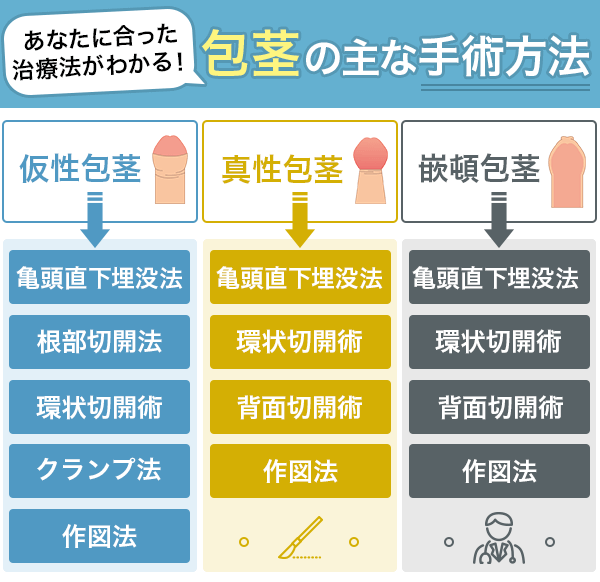 仮性包茎・真性包茎・嵌頓包茎の主な手術方法