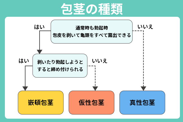 真性包茎・仮性包茎・嵌頓包茎と包茎の種類3つを示すフローチャート画像