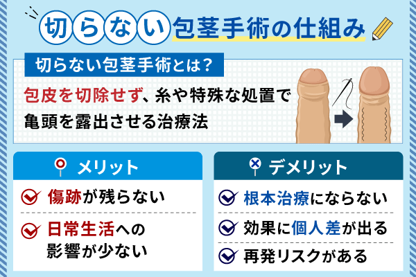 切らない包茎手術の仕組みとメリットデメリットを解説した画像