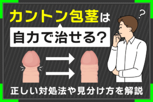 カントン包茎は自力で治せる？正しい対処法や見分け方を解説